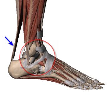 Achilles and ankle pain