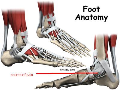 bones of foot. thethis is Bone and foot
