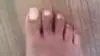 toe nails are not attached