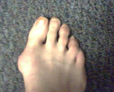 my right foot
