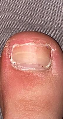 Left big toenail w/out the dot and outline (I removed the black dot) 