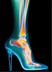 foot_xray_in_high_heels