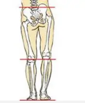 short left leg
