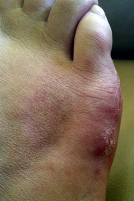 Look just below where the little toe is