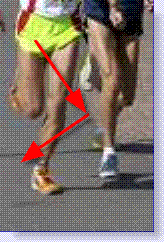 runner's knee