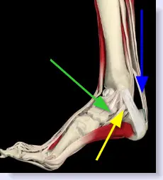 tendinitis inside part of foot