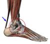 Achilles and ankle pain