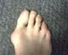 my right foot