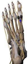sesamoid bones