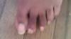 toe nails are not attachef