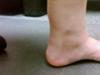 inner left ankle