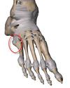 base of fifth metatarsal