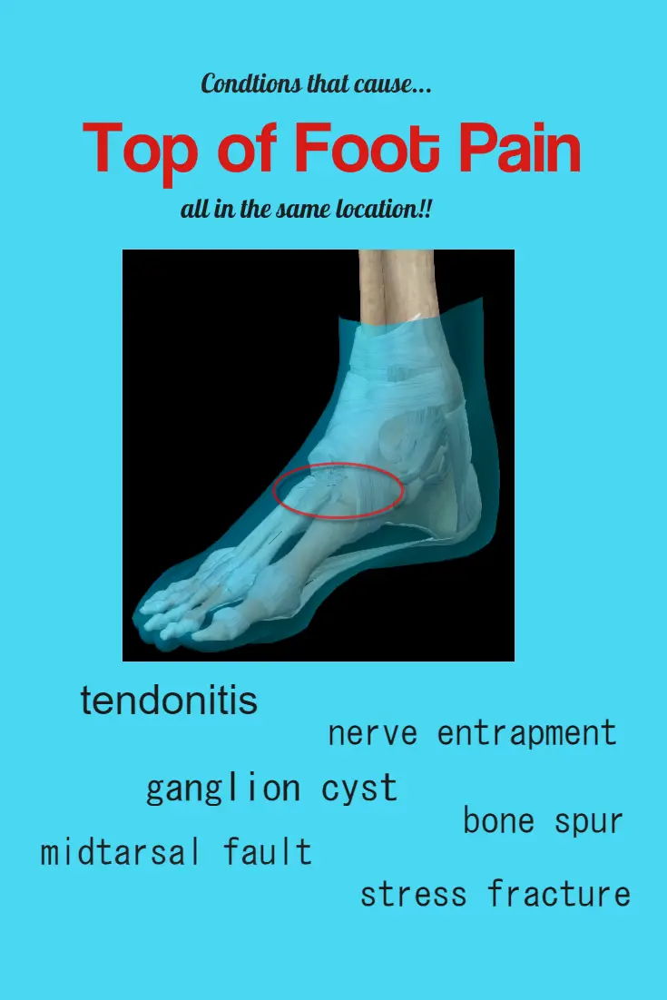 top of foot pain