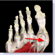 turf toe skeletal view