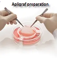 Apligraf preparation