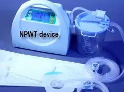 Negative Therapy Wound Treatment