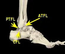 lateral ankle ligaments