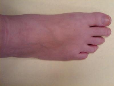 top of right foot