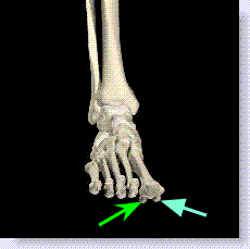 sesamoid bones in foot