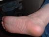Foot pain pressure @ heel/arch