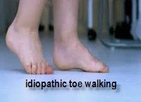 idiopathic toe walking